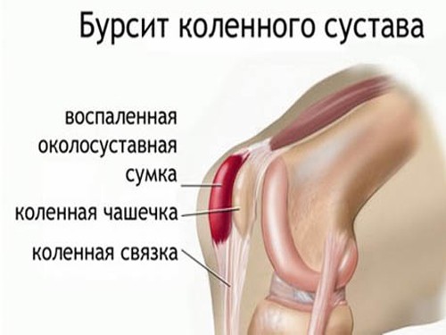 Натуральный бодибилдинг. Фото без стероидов, программа тренировок Натуральный бодибилдинг. Фото без стероидов, программа тренировок
