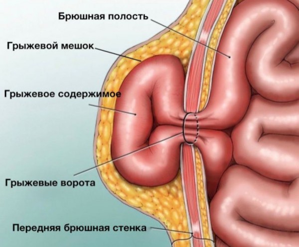 Планка упражнение. Польза для женщин, виды, фото до и после