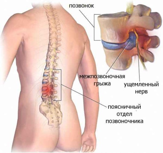 Фронтальная тяга в тренажере сидя, широким, обратным хватом