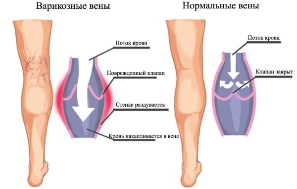 Степ-аэробика для начинающих для похудения. Польза