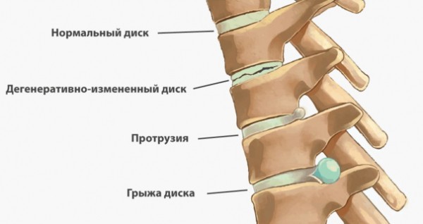 Алмазные отжимания. Какие мышцы работают, что качают